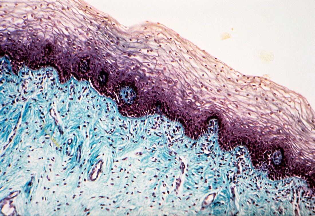 Vaginal mucosa,light micrograph
