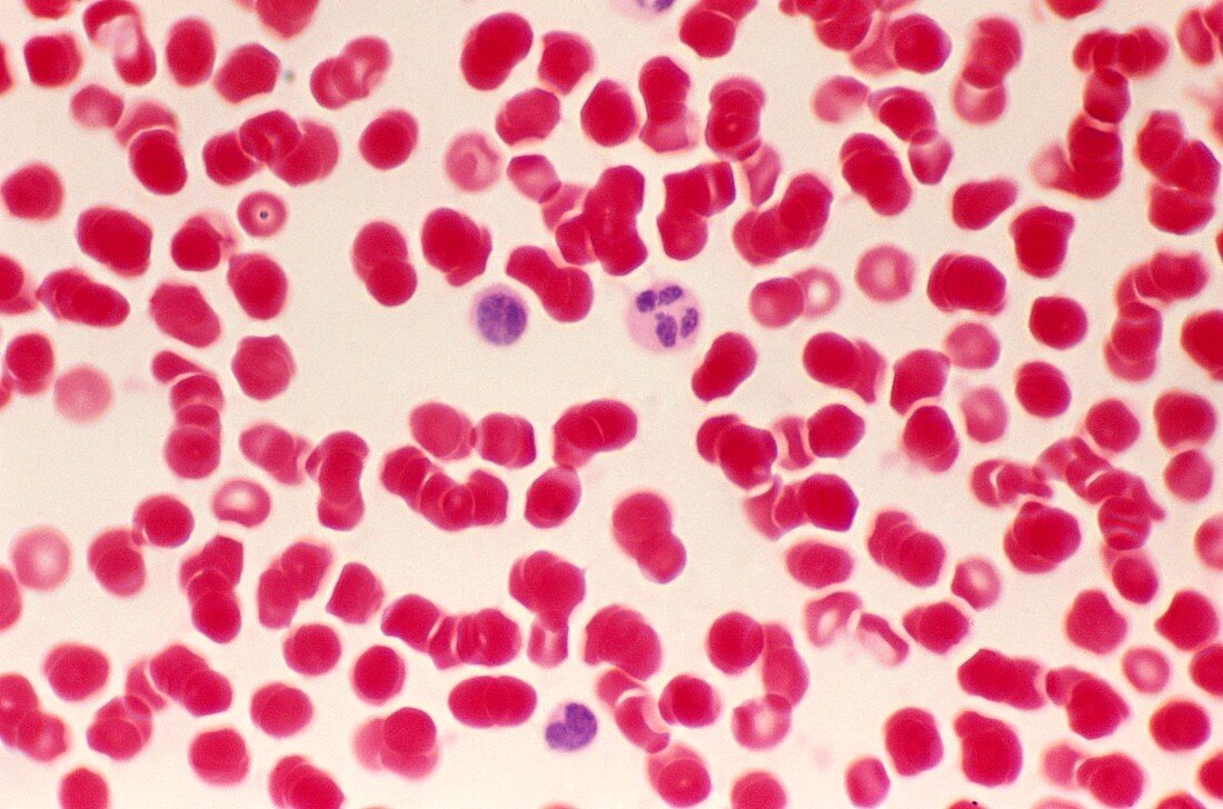 Blood cells,light micrograph