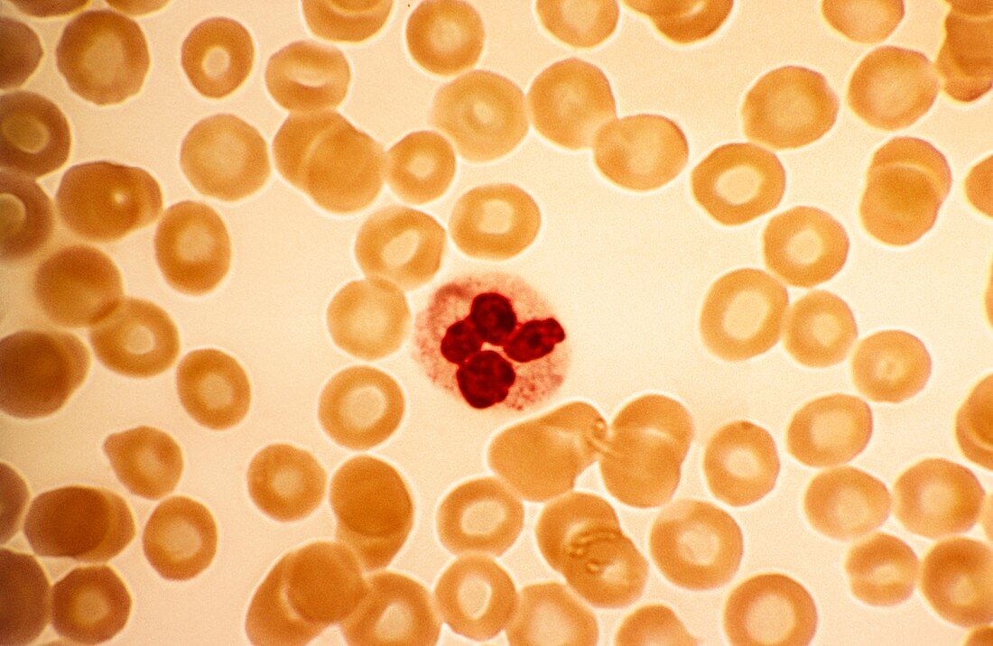Dohle bodies in blood cell,micrograph