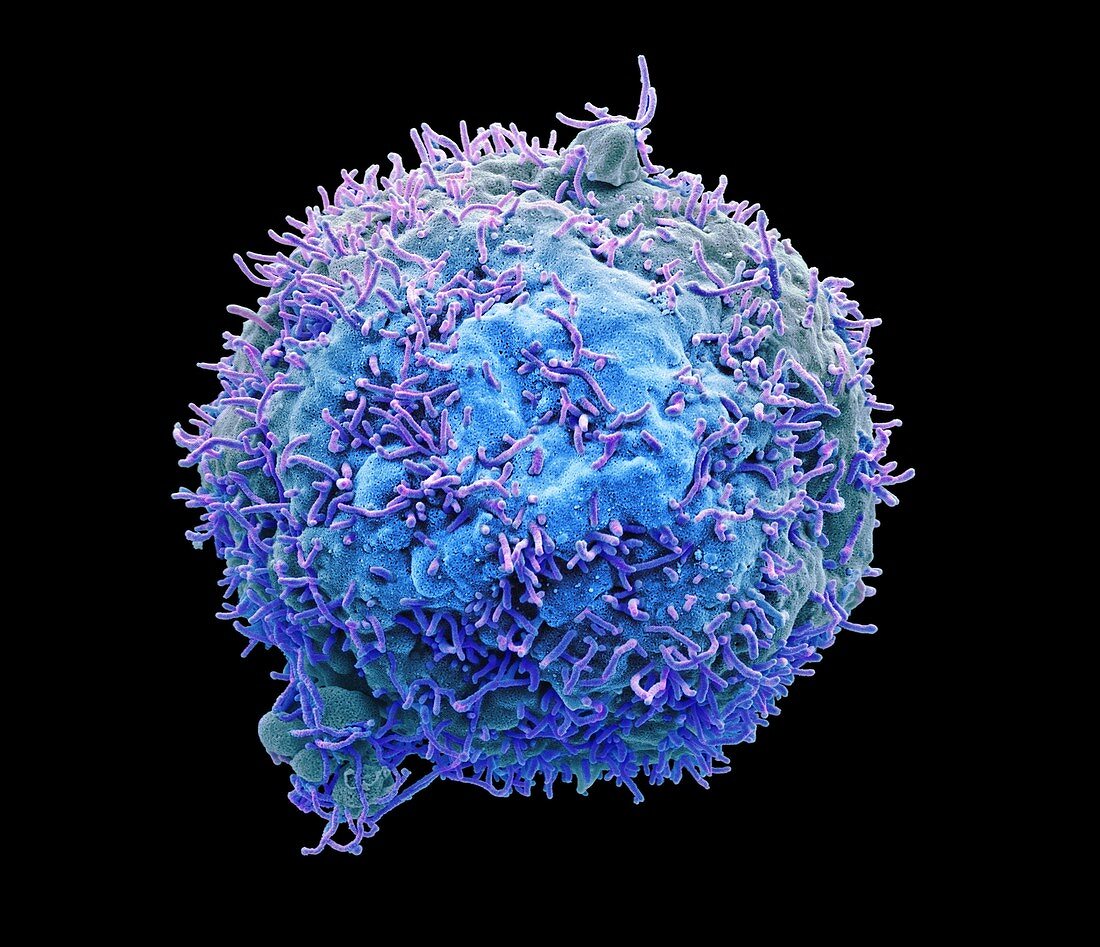 Liver cancer cell,SEM