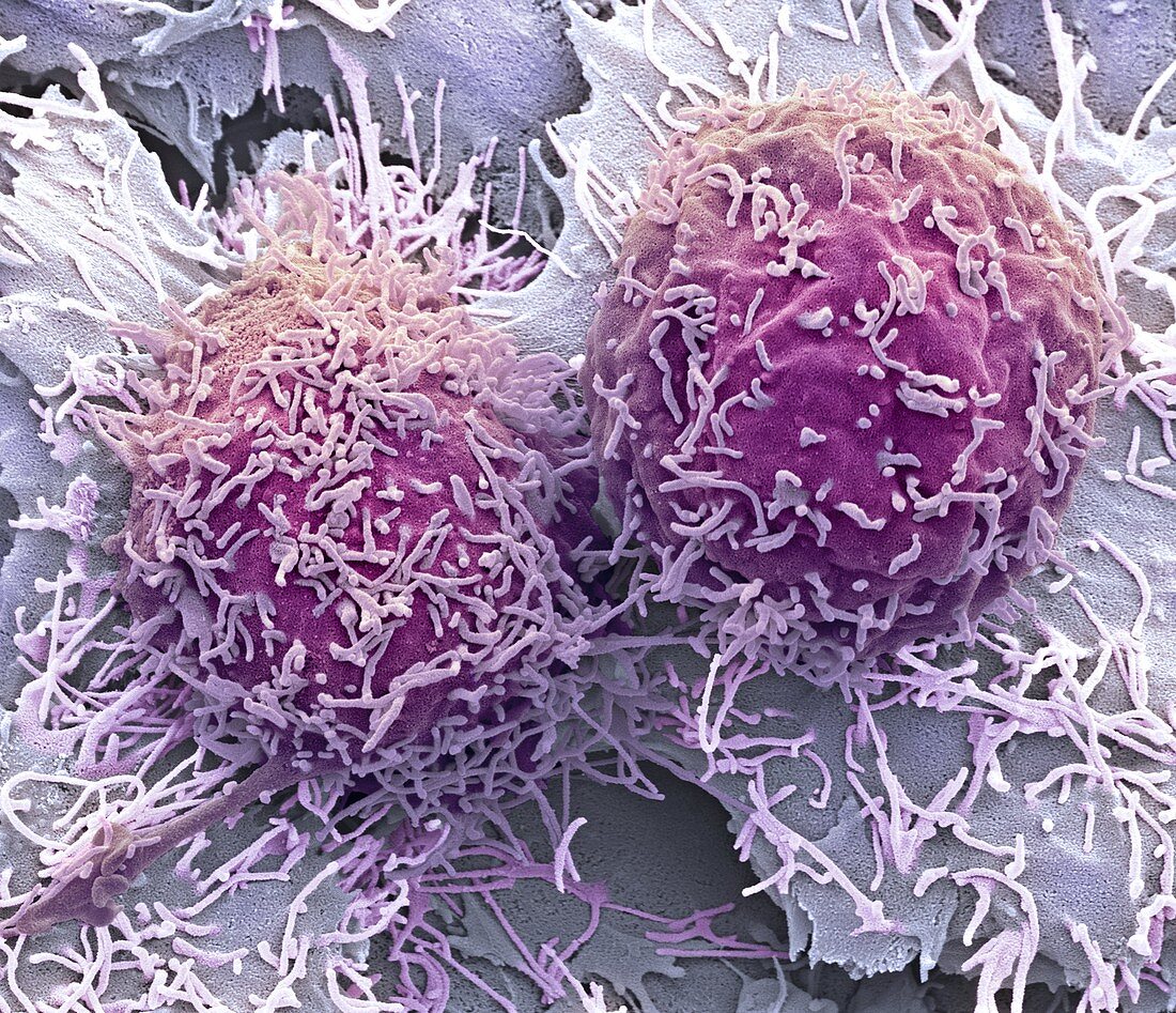 Liver cancer cells,SEM