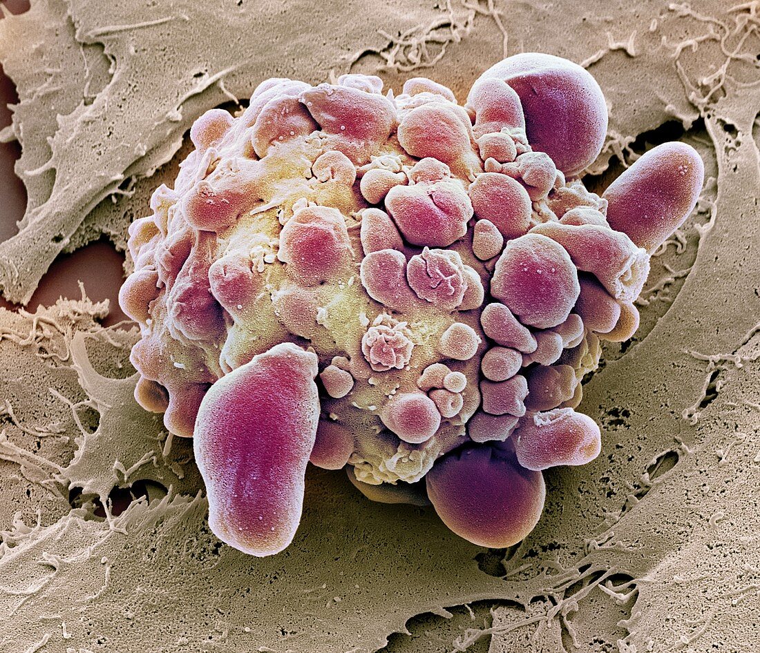 Stem cell dying,SEM
