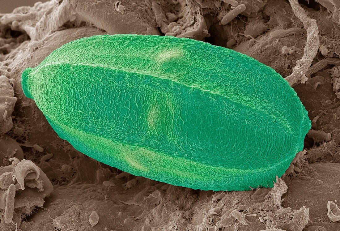 Insect egg,SEM