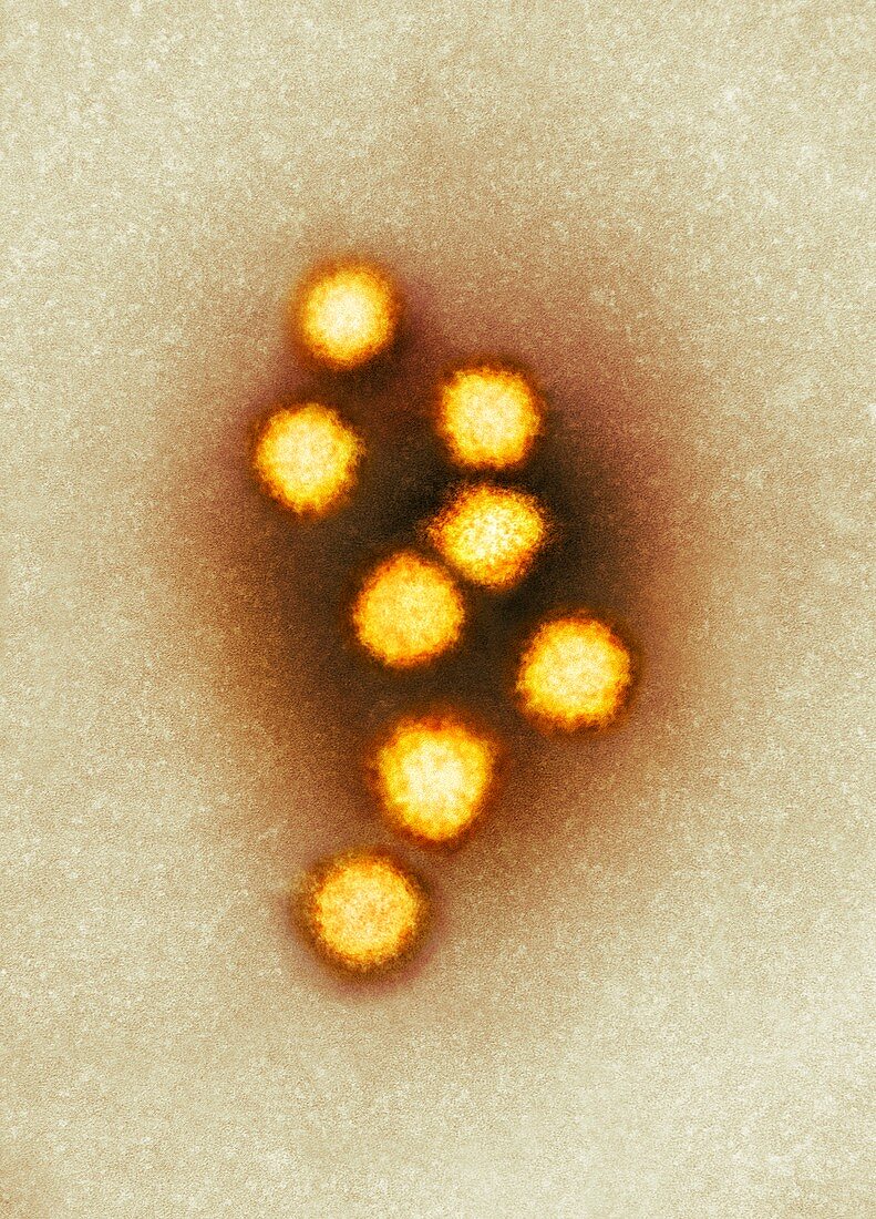 Schmallenberg virus particles,TEM