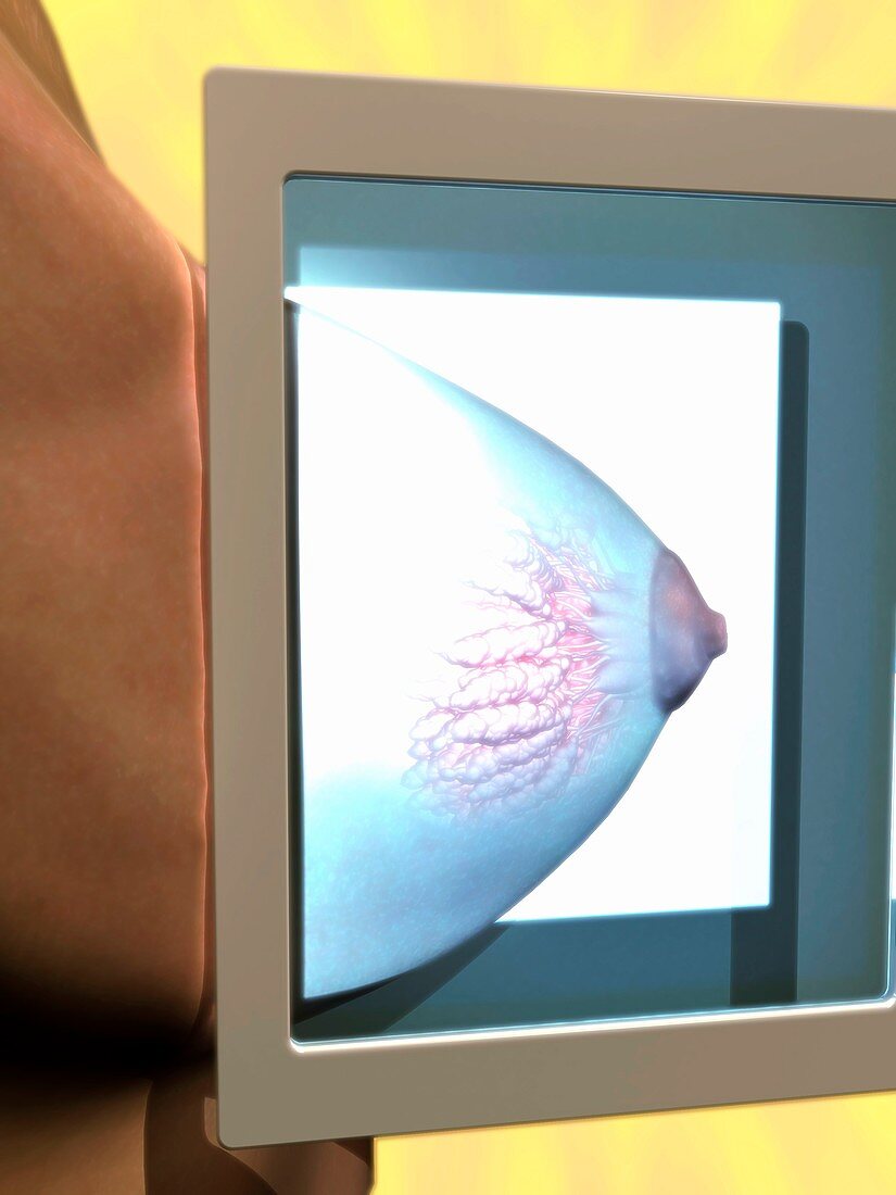 Mammogram,conceptual image