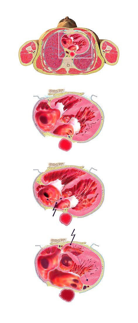 Human heart,anatomical artwork