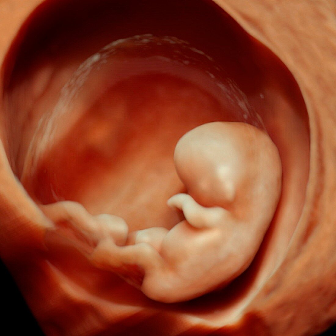 10 week foetus,3-D ultrasound scan