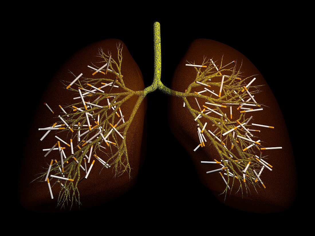 Smoker's lung,conceptual artwork