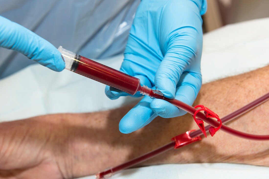 Haemodialysis: blood sampling