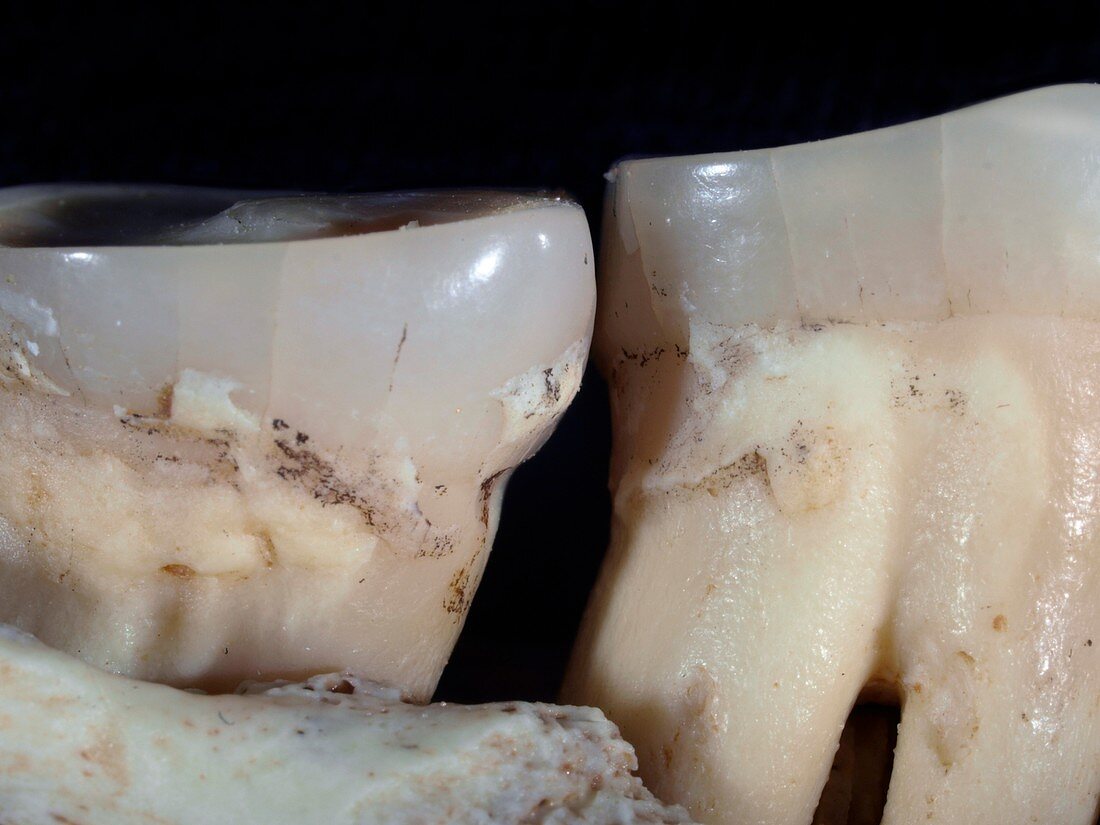 Homo heidelbergensis teeth