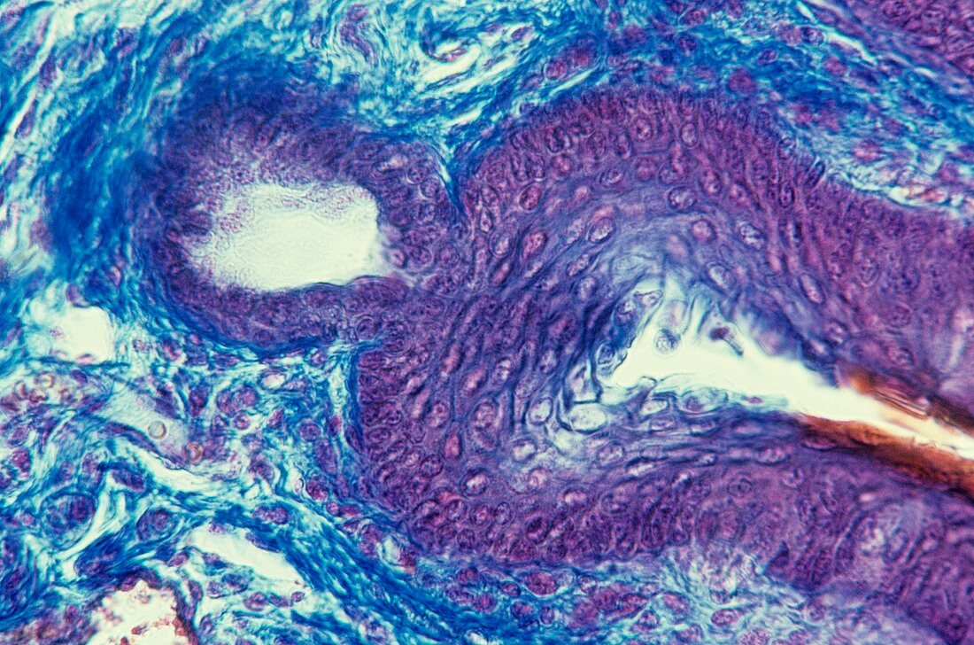 Sebaceous gland,light micrograph