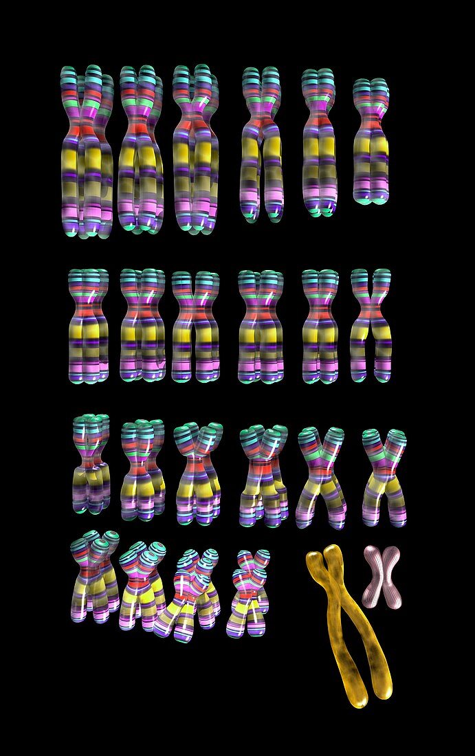Male karyotype with 21