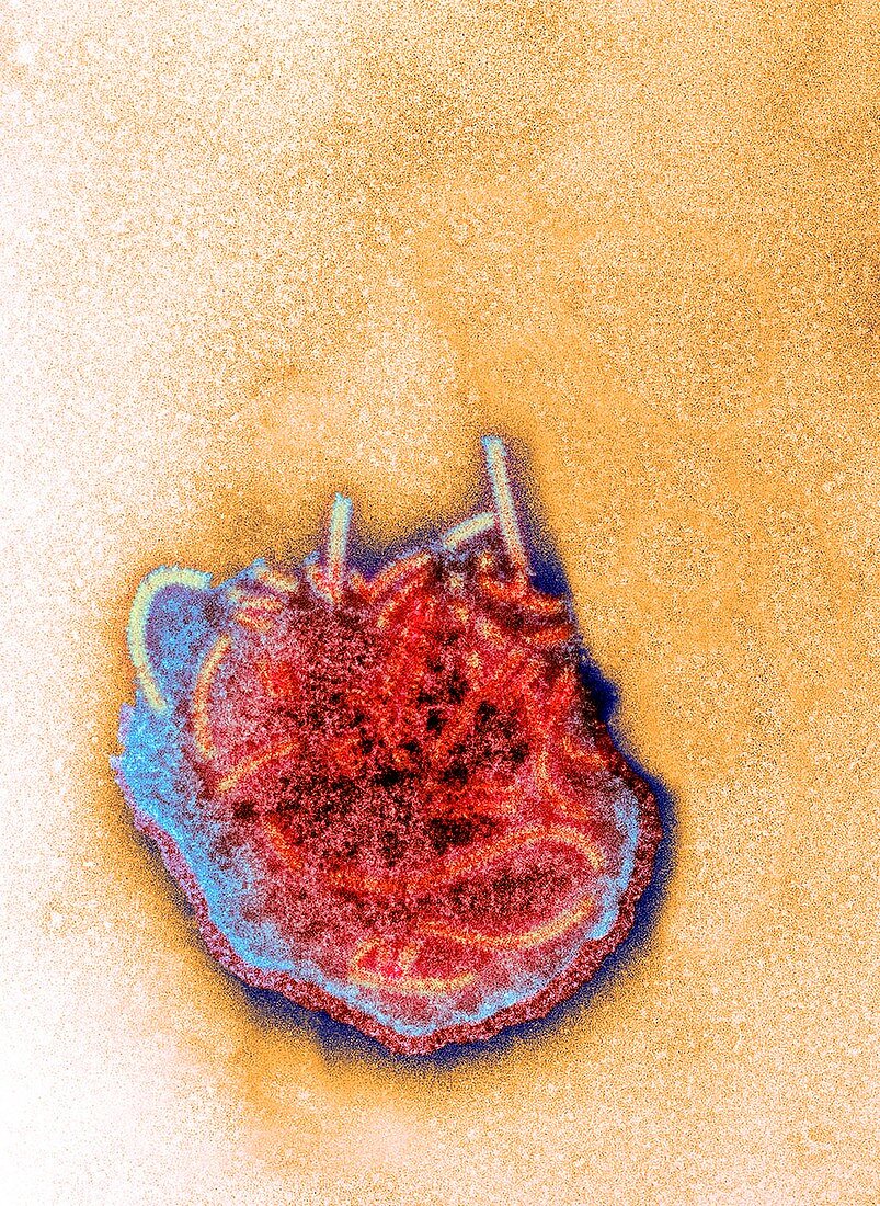 Measles virus particle,TEM