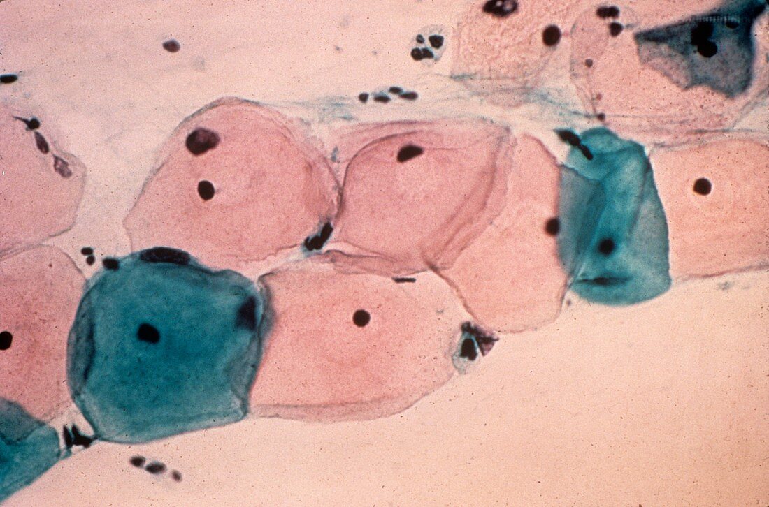 Healthy cervical smear,micrograph