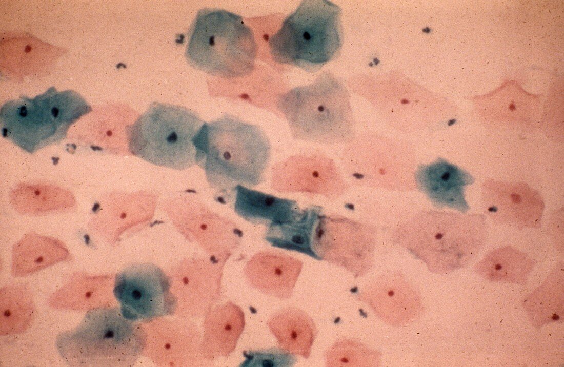 Healthy cervical smear,micrograph