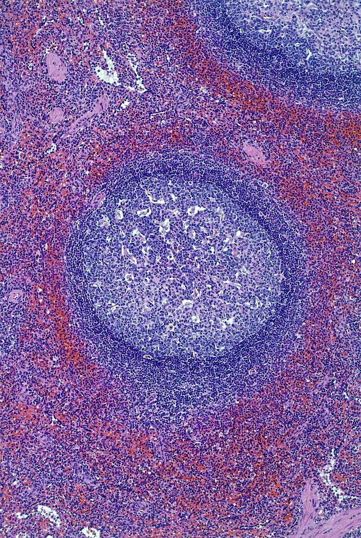 Lymphoid follicle,light micrograph