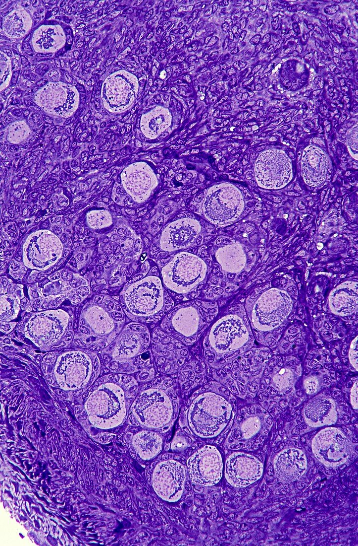 Ovarian primordial follicles,micrograph