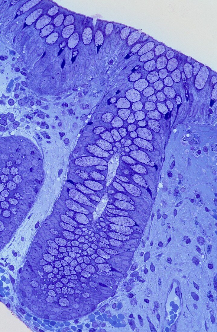 Large intestine,light micrograph