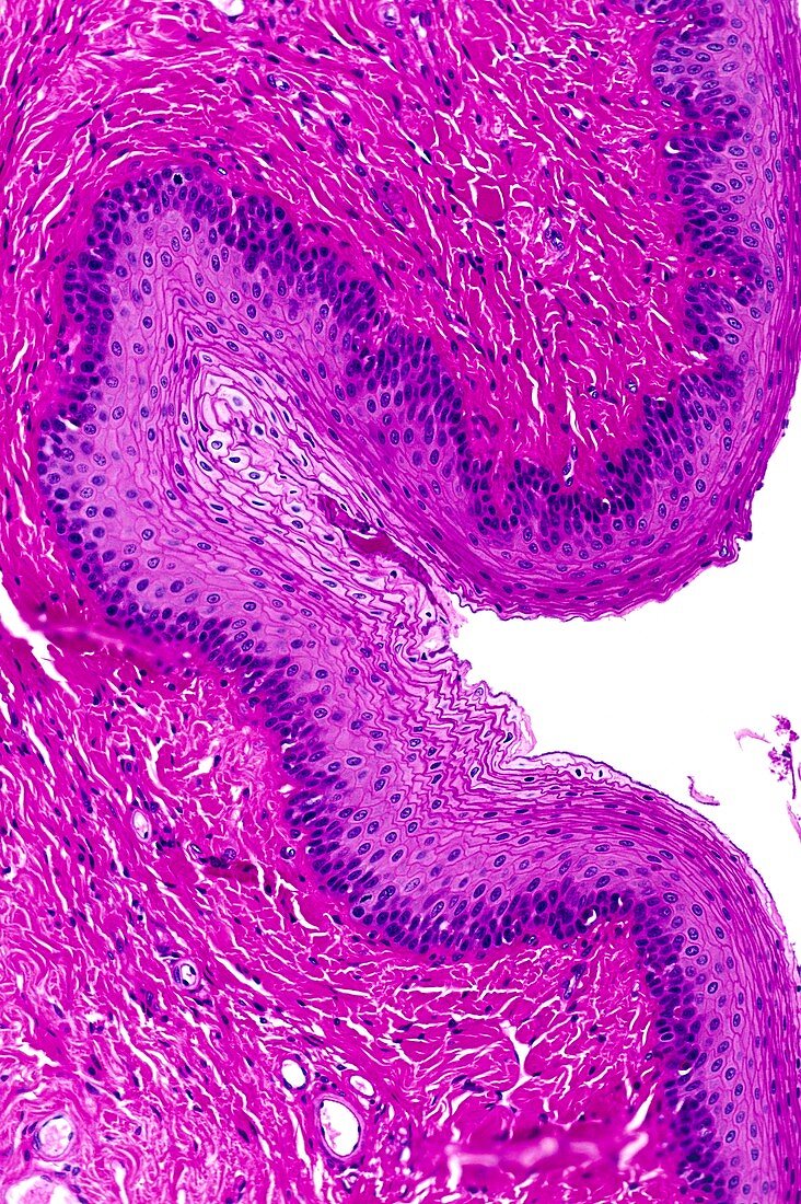 Stratified squamous epithelium