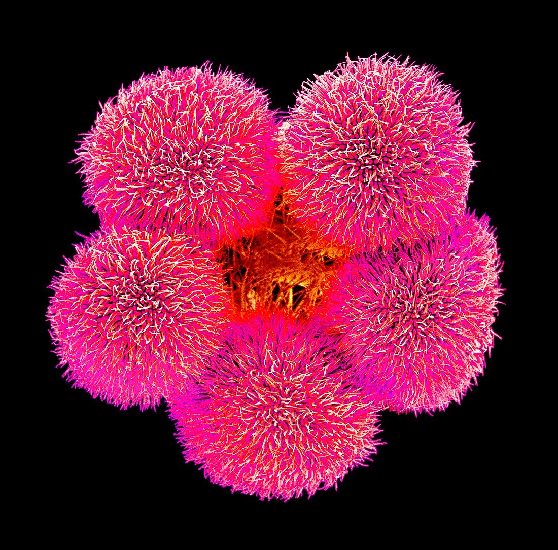 Hibiscus flower pistil,SEM