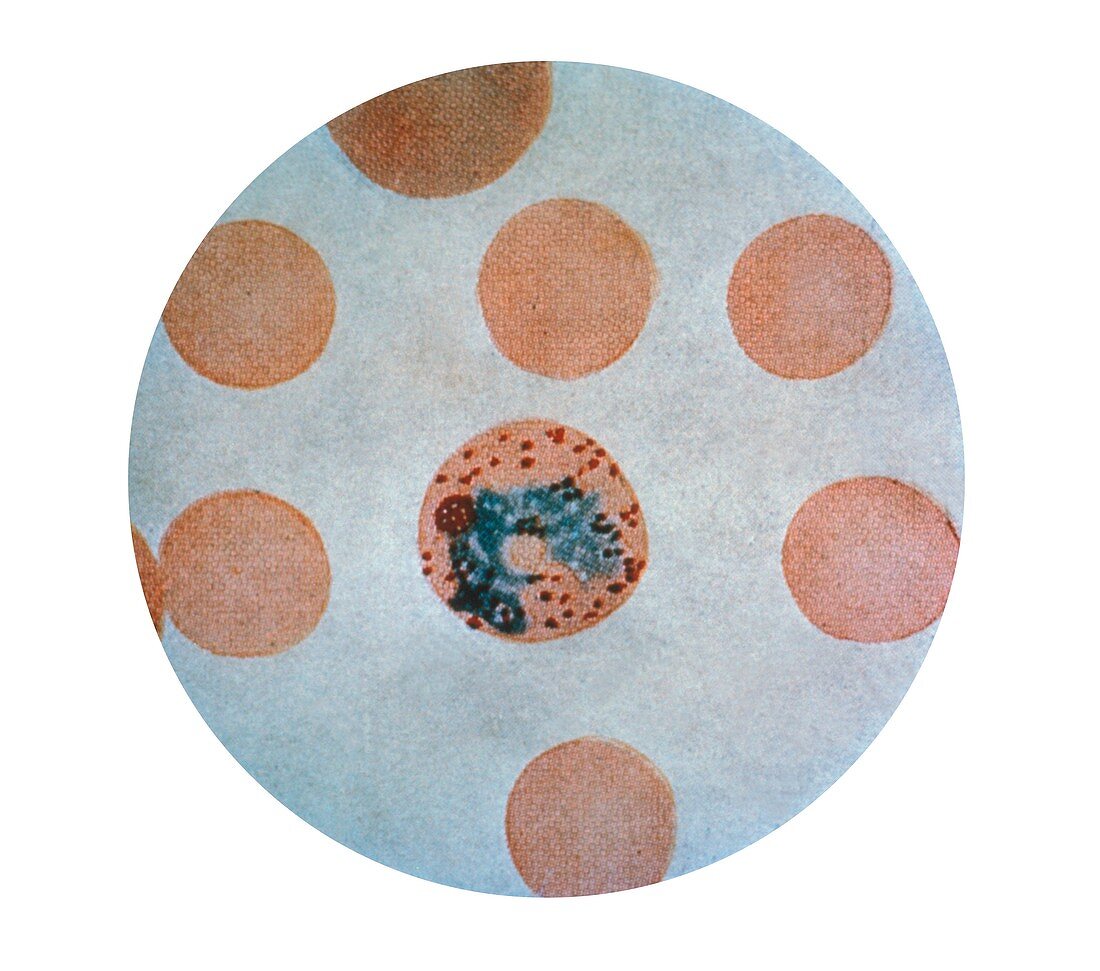 Malaria parasite in red blood cell