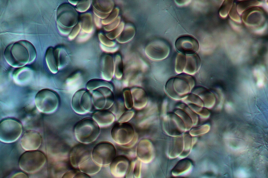 Red blood cells,light micrograph