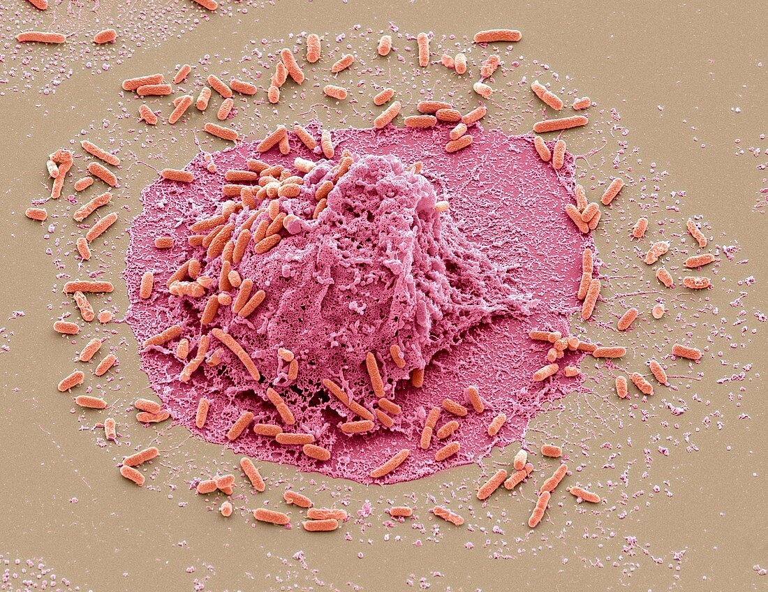 E. coli induced cell death,SEM