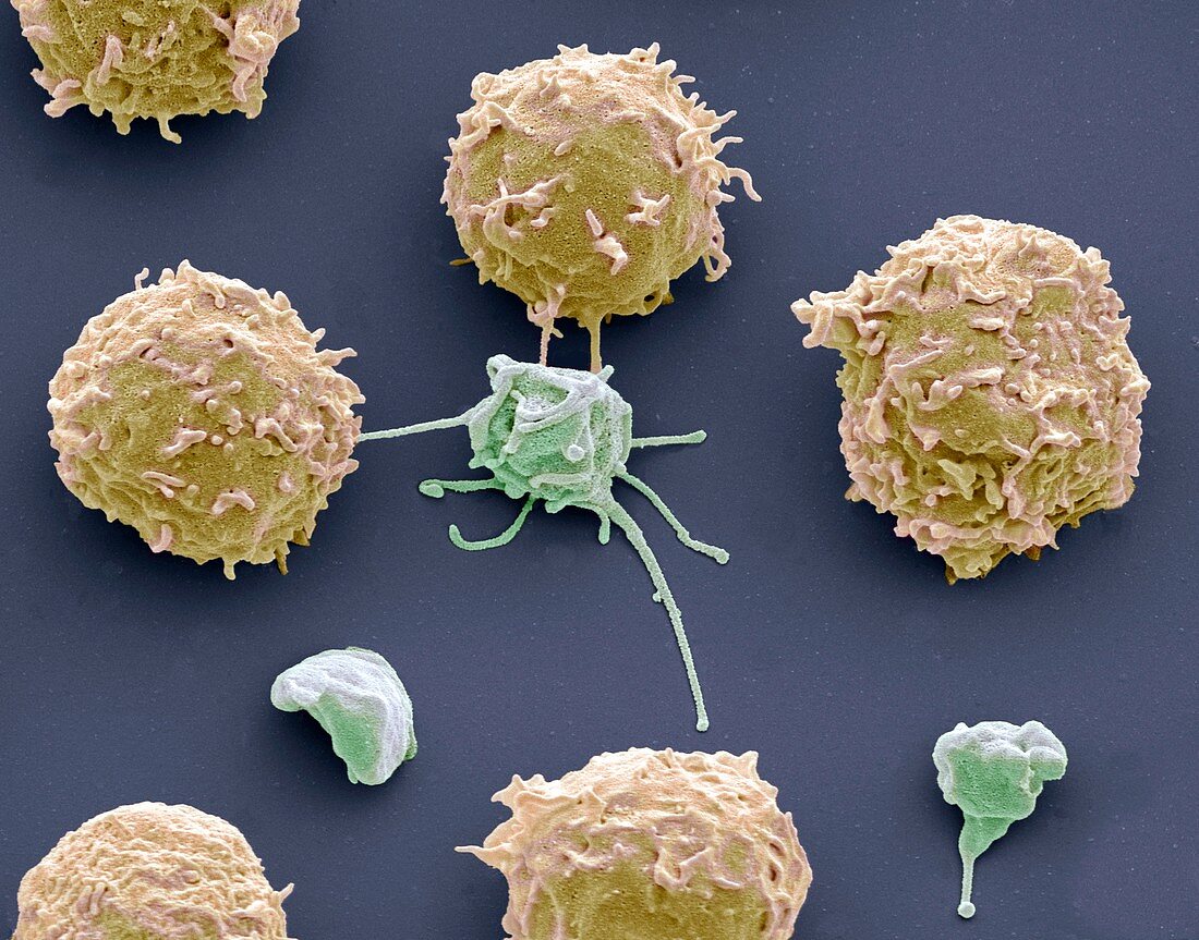 White blood cells and platelets,SEM