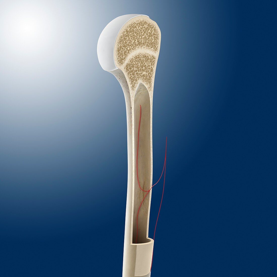 Humeral bone marrow cavity,artwork