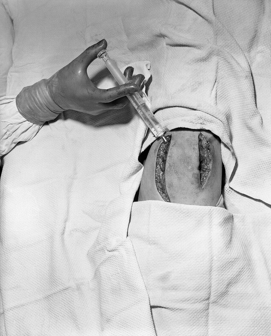 Penicillin injection,World War II