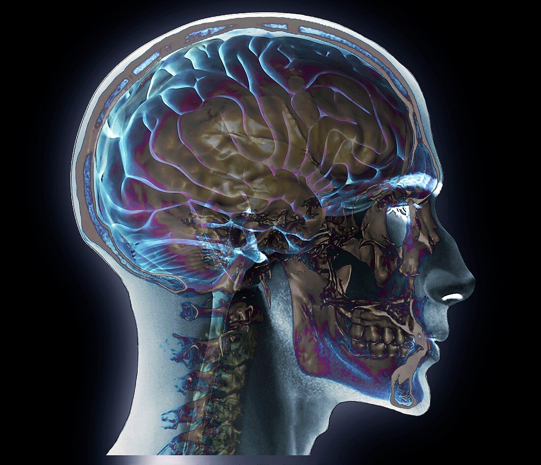 Normal head and neck,MRI and 3D CT scans