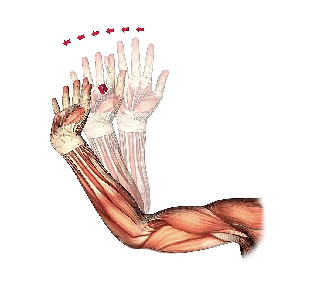 Elbow and wrist extension,artwork