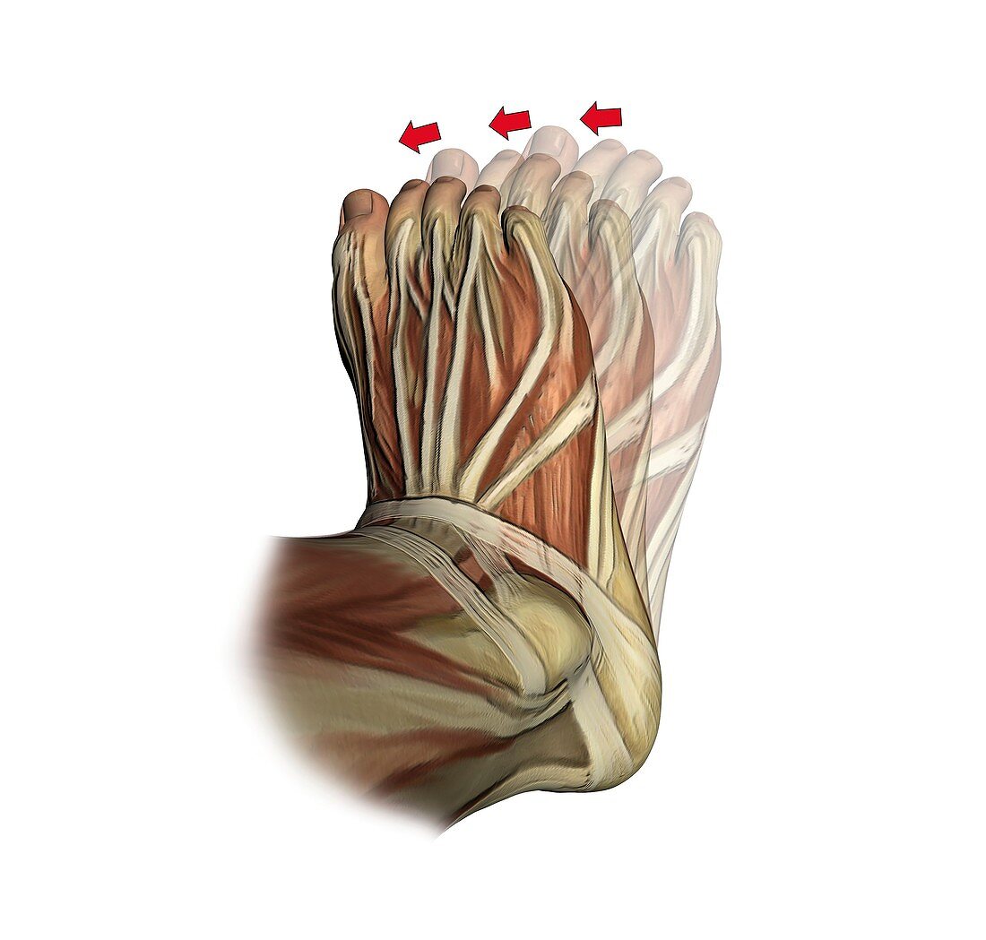 Inversion of the foot,artwork