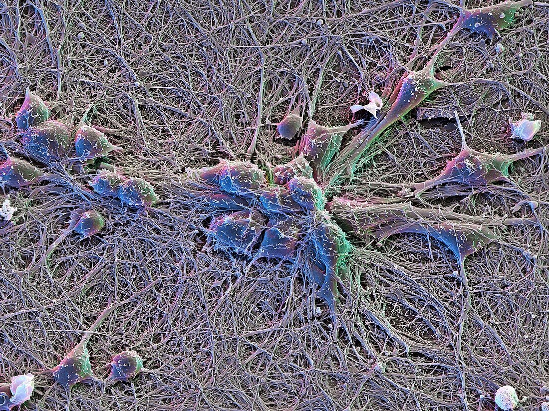 Brain nerve cells,SEM