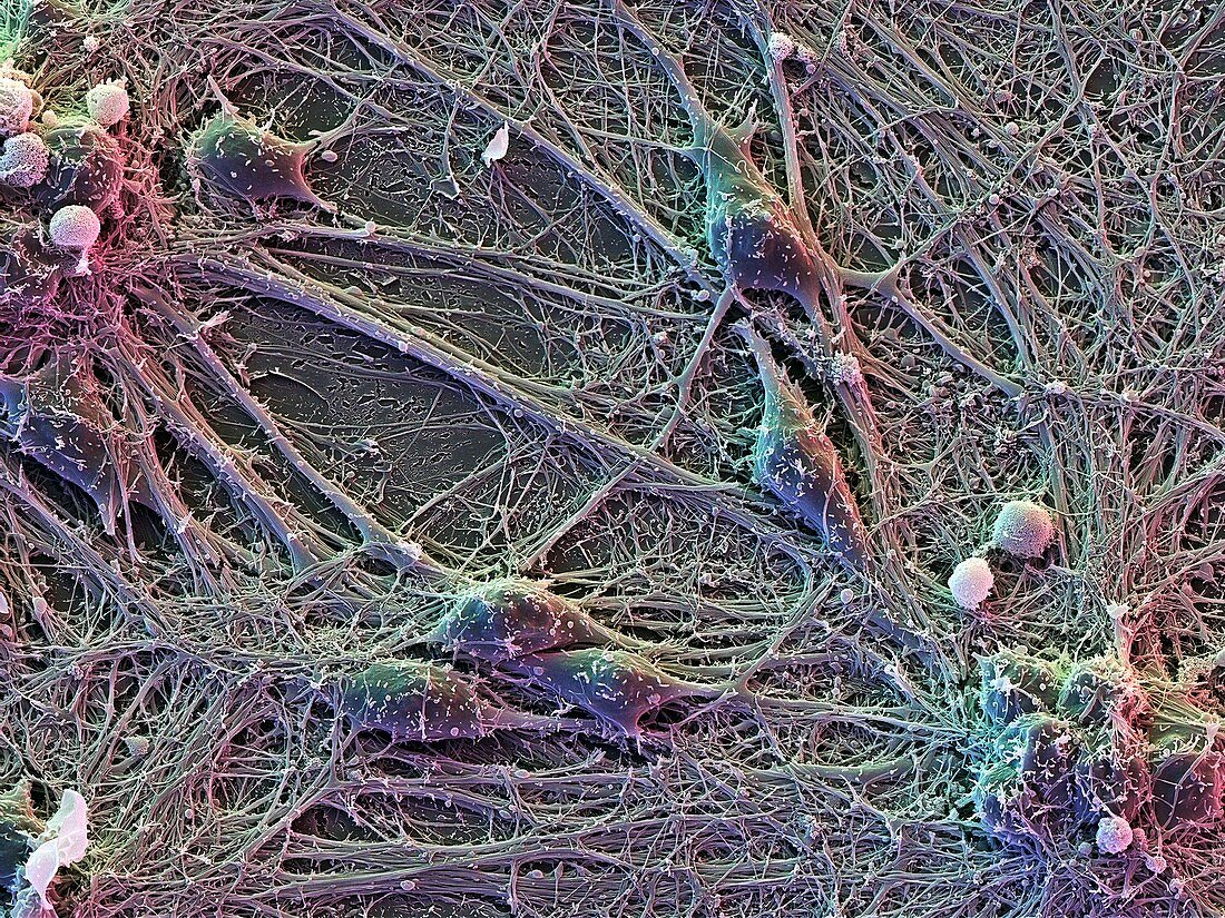 Brain nerve cells,SEM