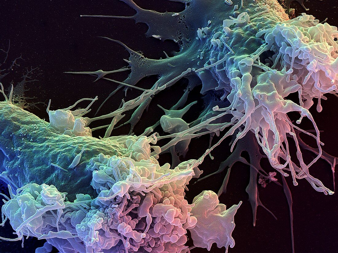 Lymphoblast white blood cells,SEM