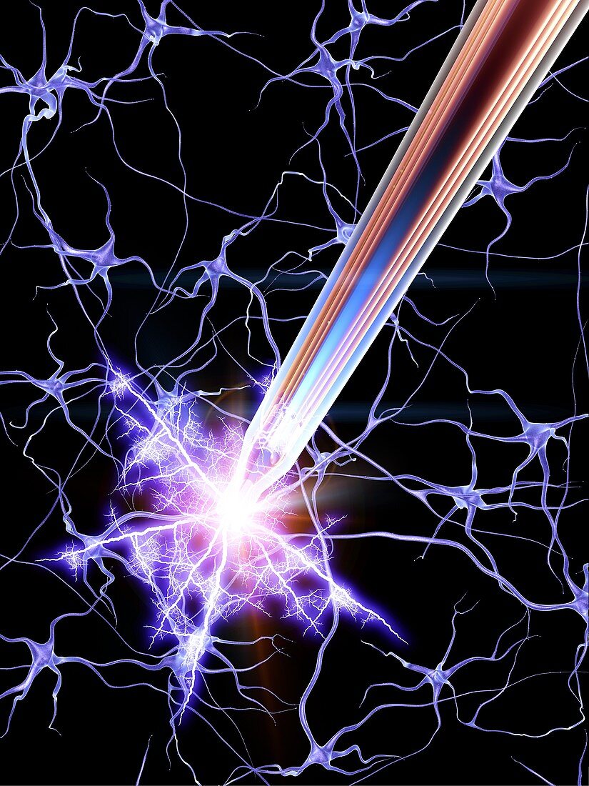 Deep brain stimulation and nerve cells