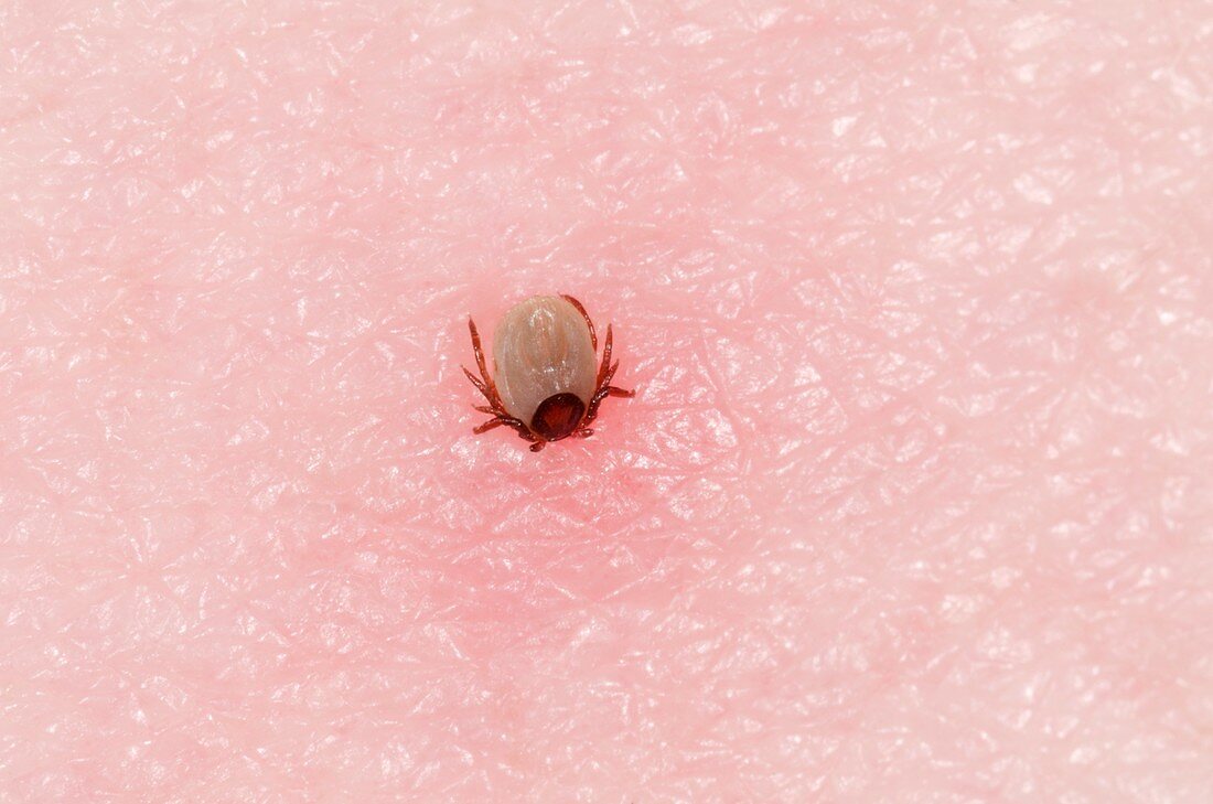 Tick biting into the skin