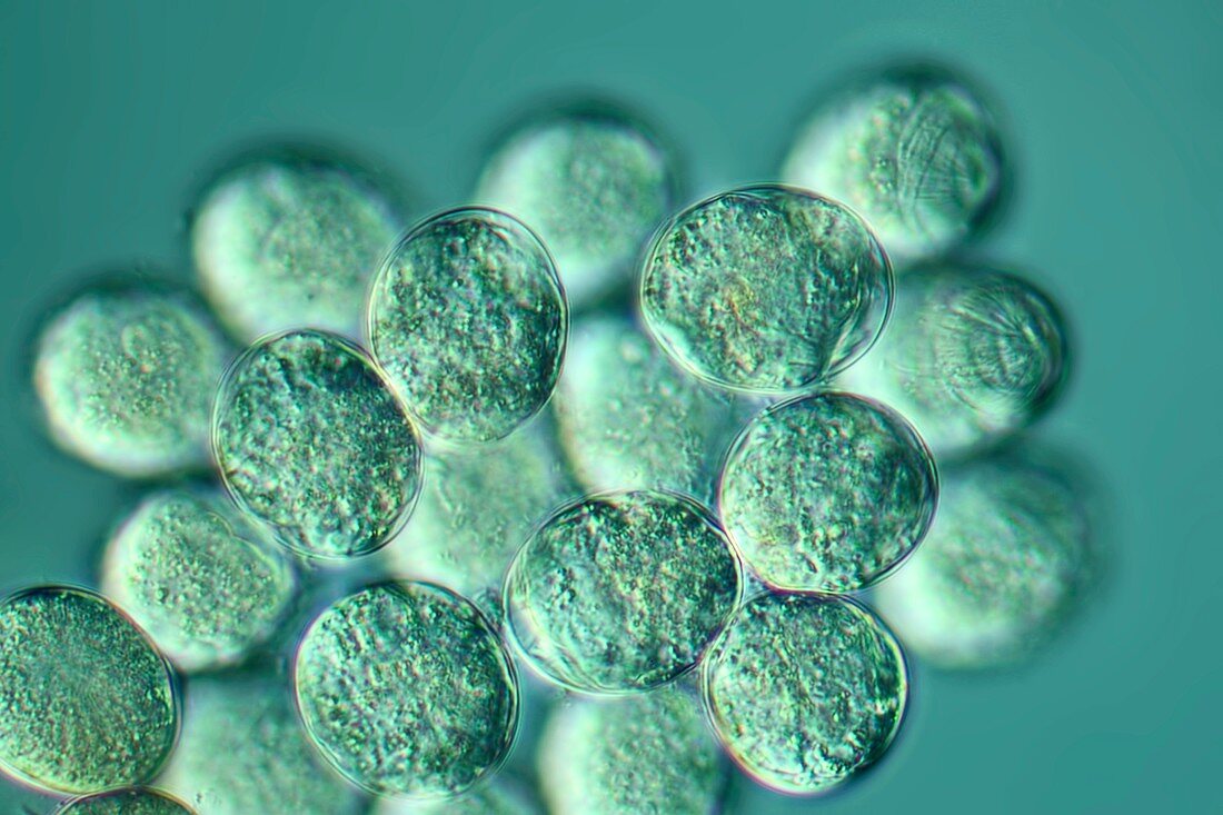Rotifer eggs,light micrograph