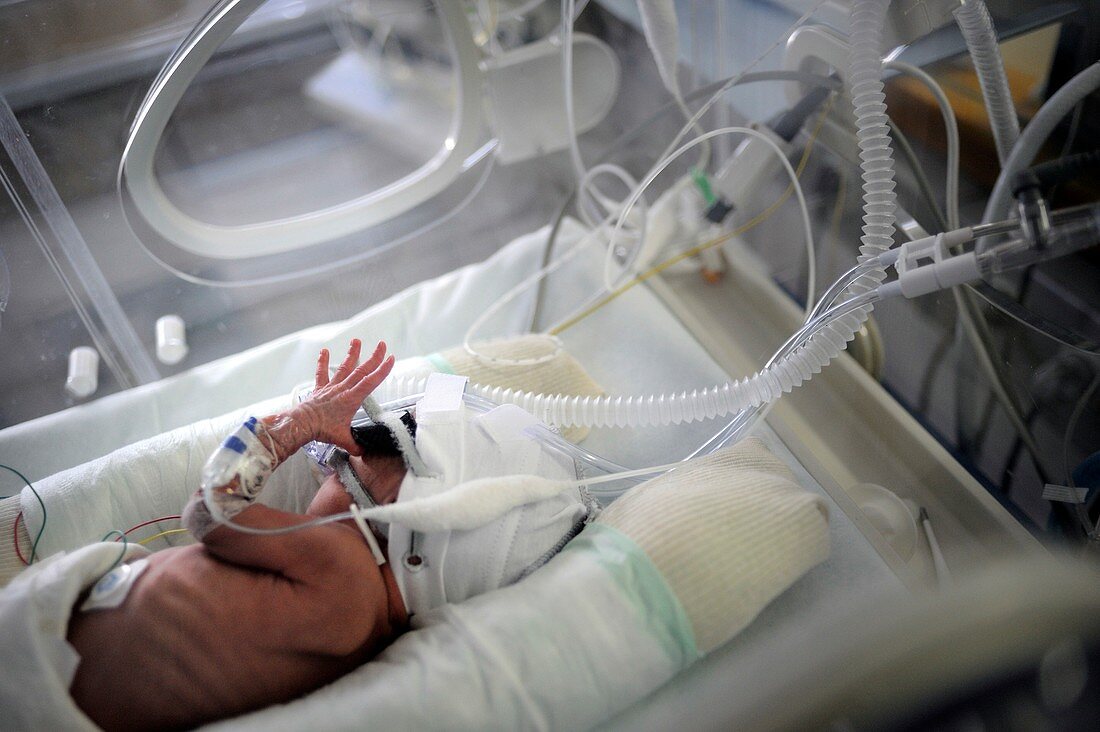 Premature baby intensive care unit