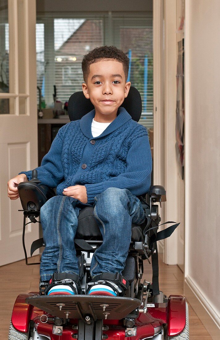 Child with muscular dystrophy