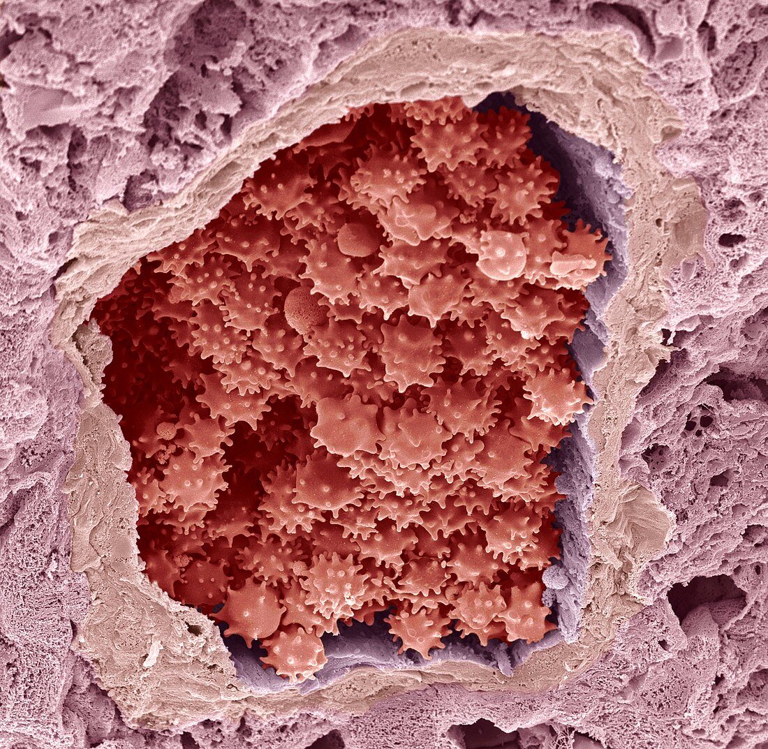 Crenated red blood cells,SEM