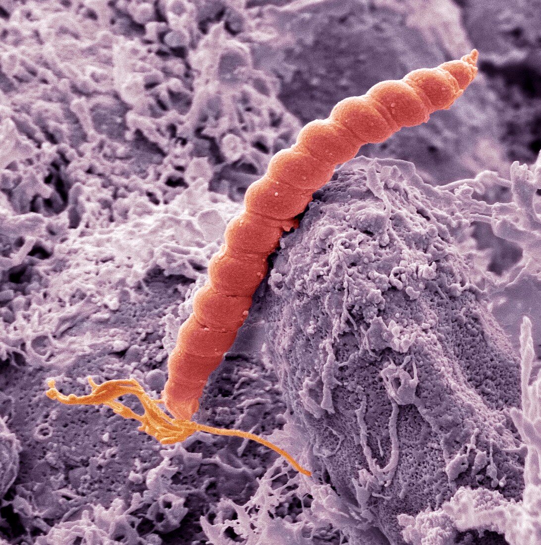 Helicobacter pylori bacteria,SEM