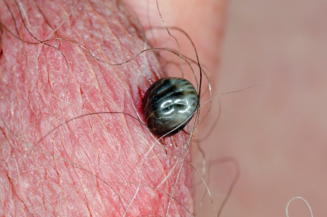 Tick biting into the skin