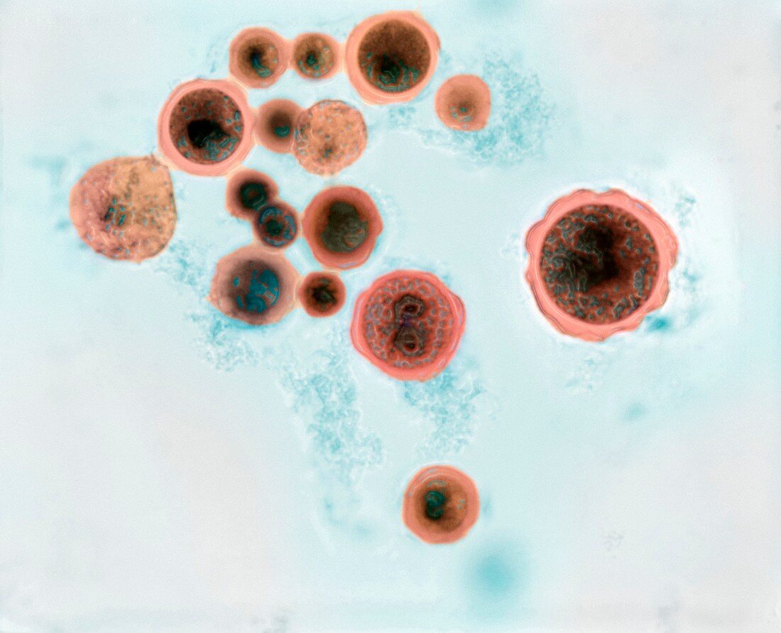 Hartmannella vermiformis protozoa cysts