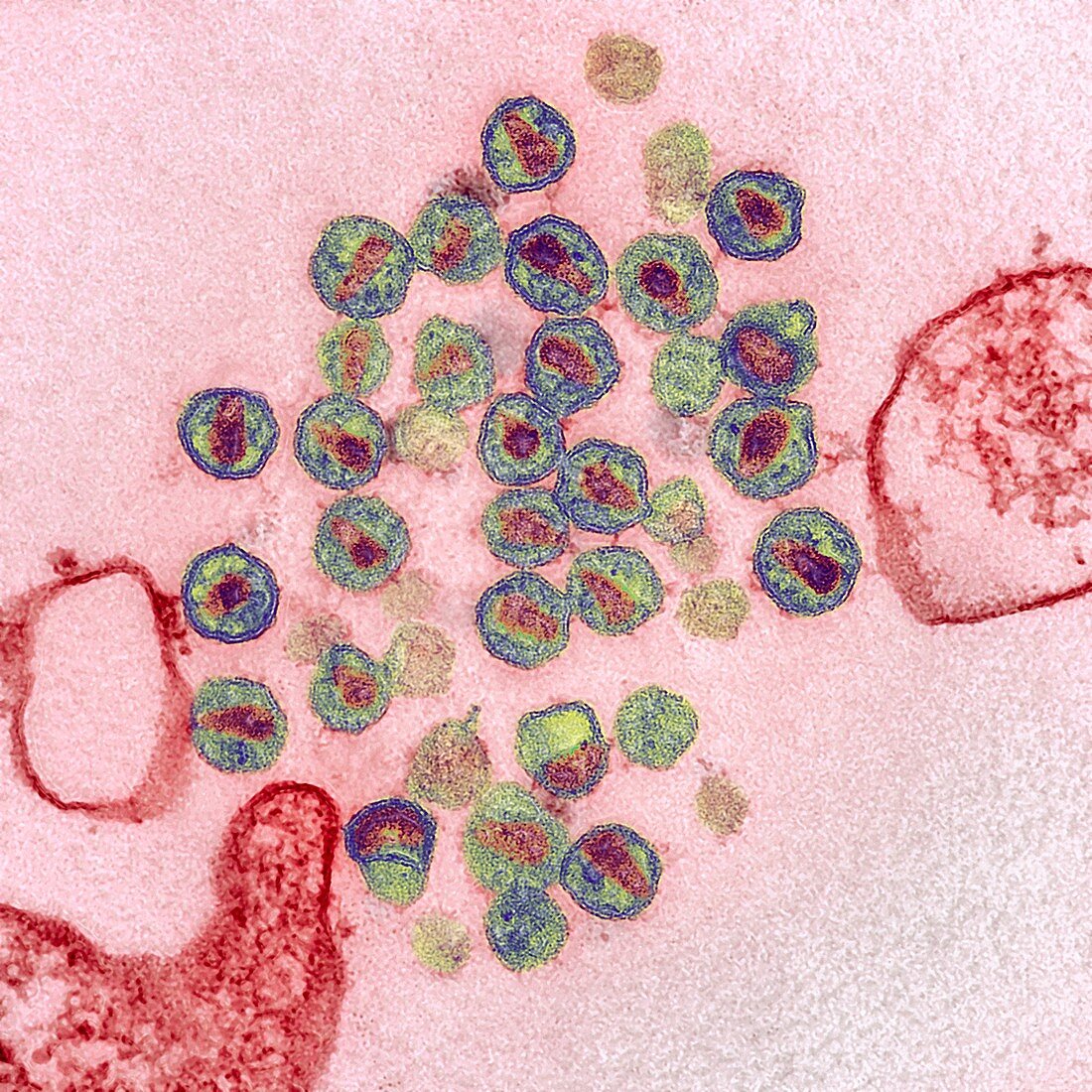 HIV virus particles,TEM