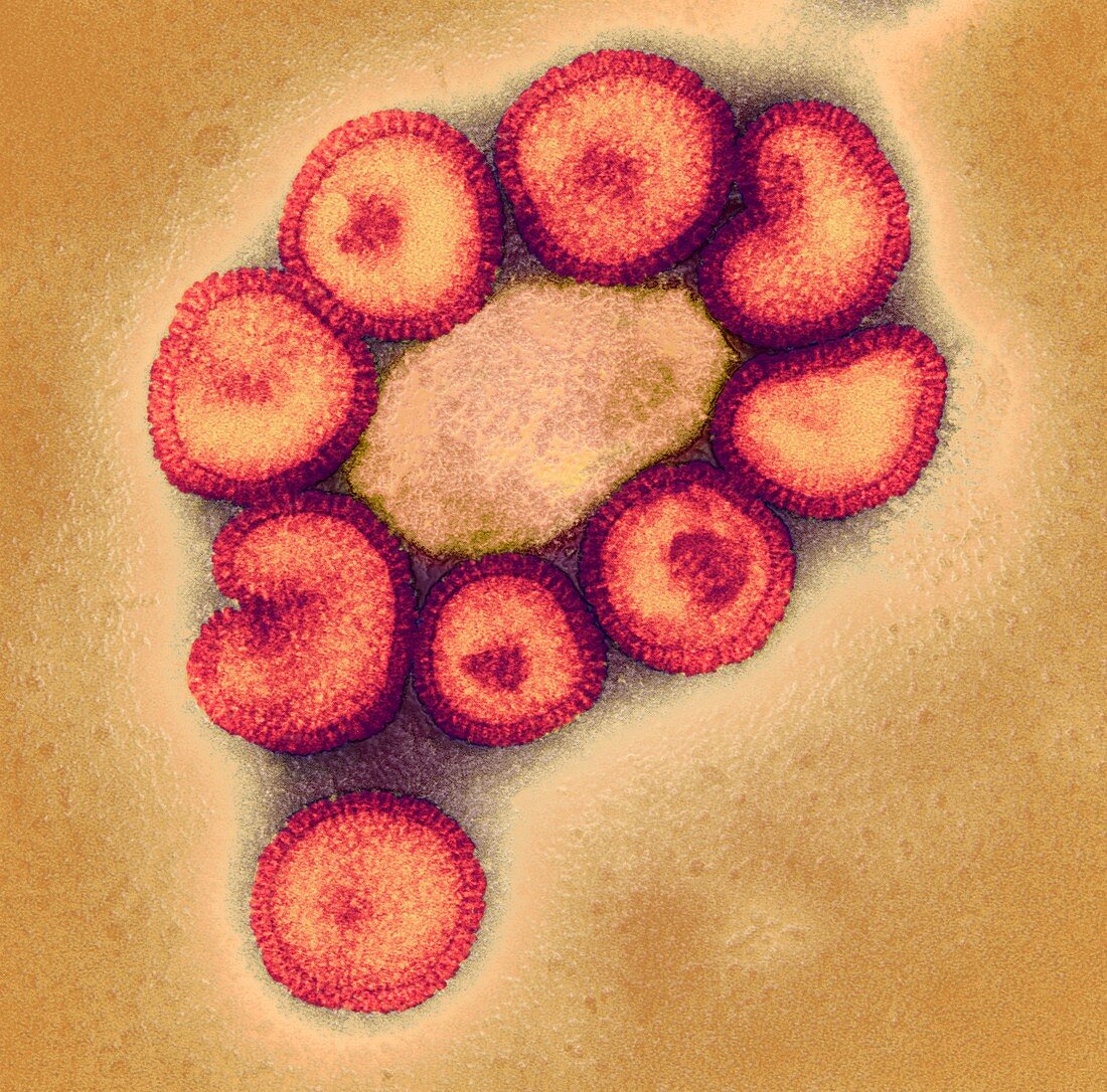 Swine flu virus particles,TEM