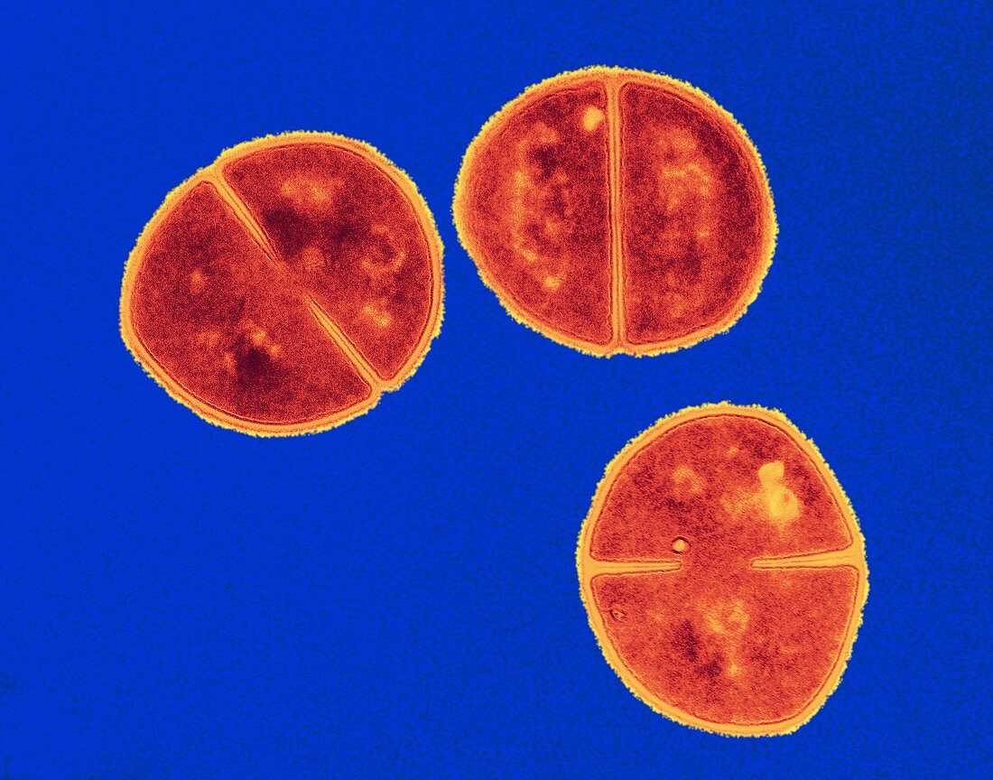 Staphylococcus aureus bacteria,TEM