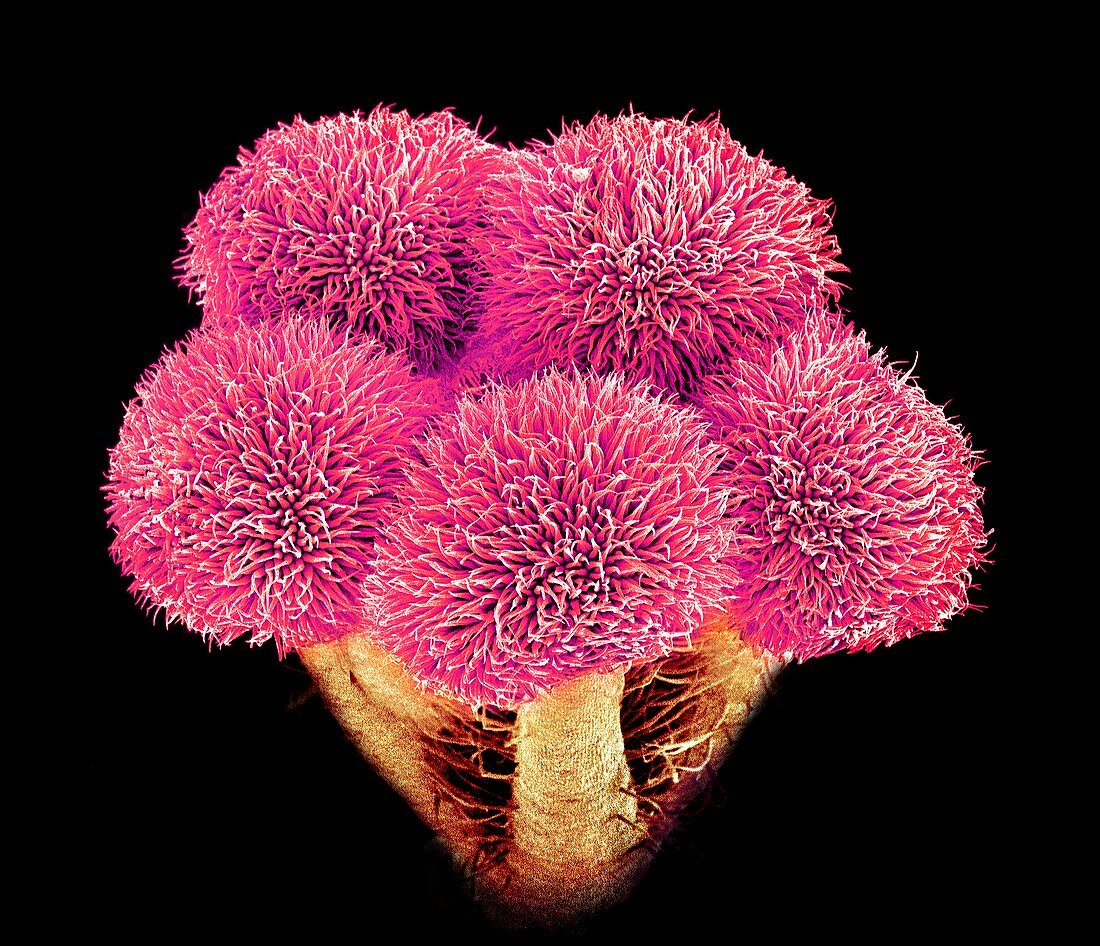 Hibiscus flower pistil,SEM