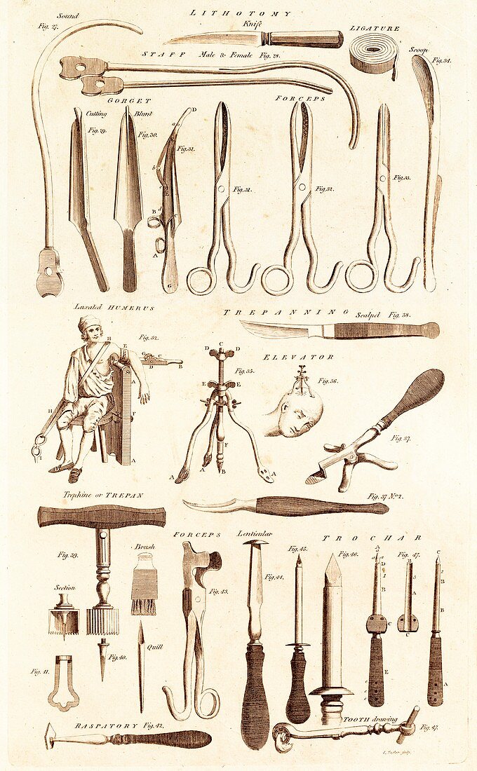 Instruments for Lithotomy and Trepanning